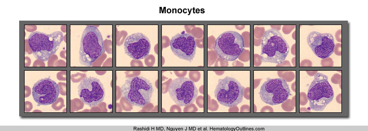 reactive lymphocytes vs monocytes