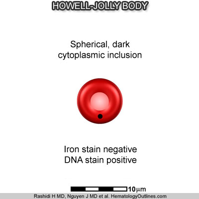 Image result for howell jolly bodies